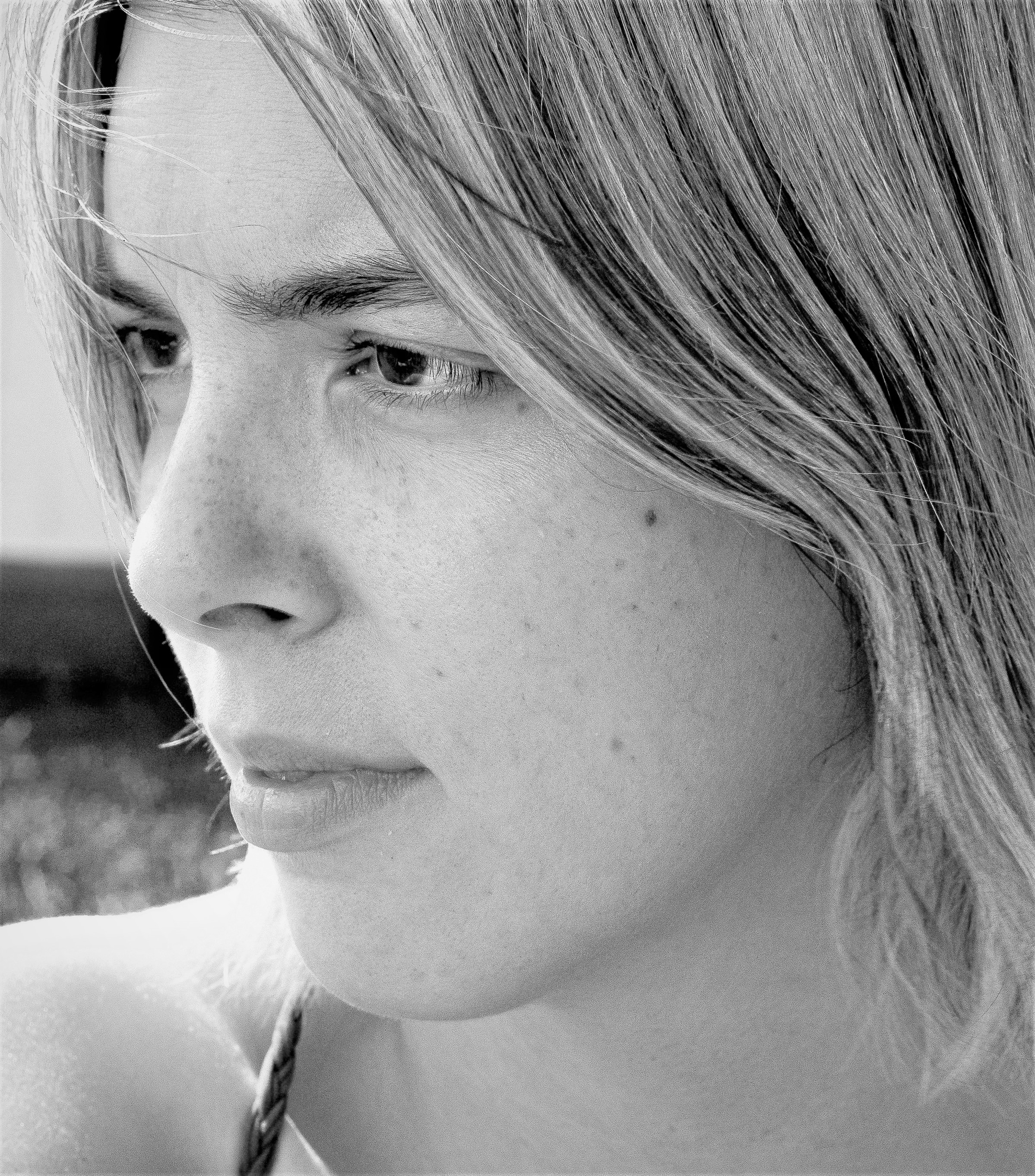 Masz pryszcza? Nie drap i nie wyciskaj