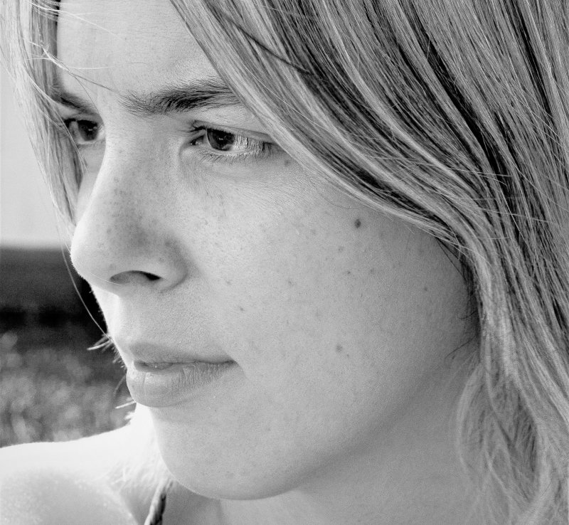 Masz pryszcza? Nie drap i nie wyciskaj